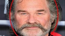 Kurt Russell had what medical conditions?