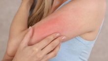 5 Ways Skin Can Signal Health Problems