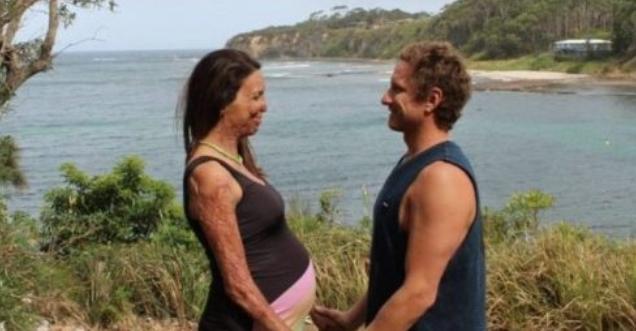 After a fire damaged his wife’s beauty, the husband refuses to leave ...