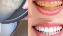 Don’t waste money on the dentist anymore